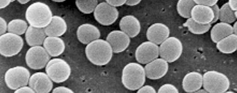 Staphylococcus Aureus